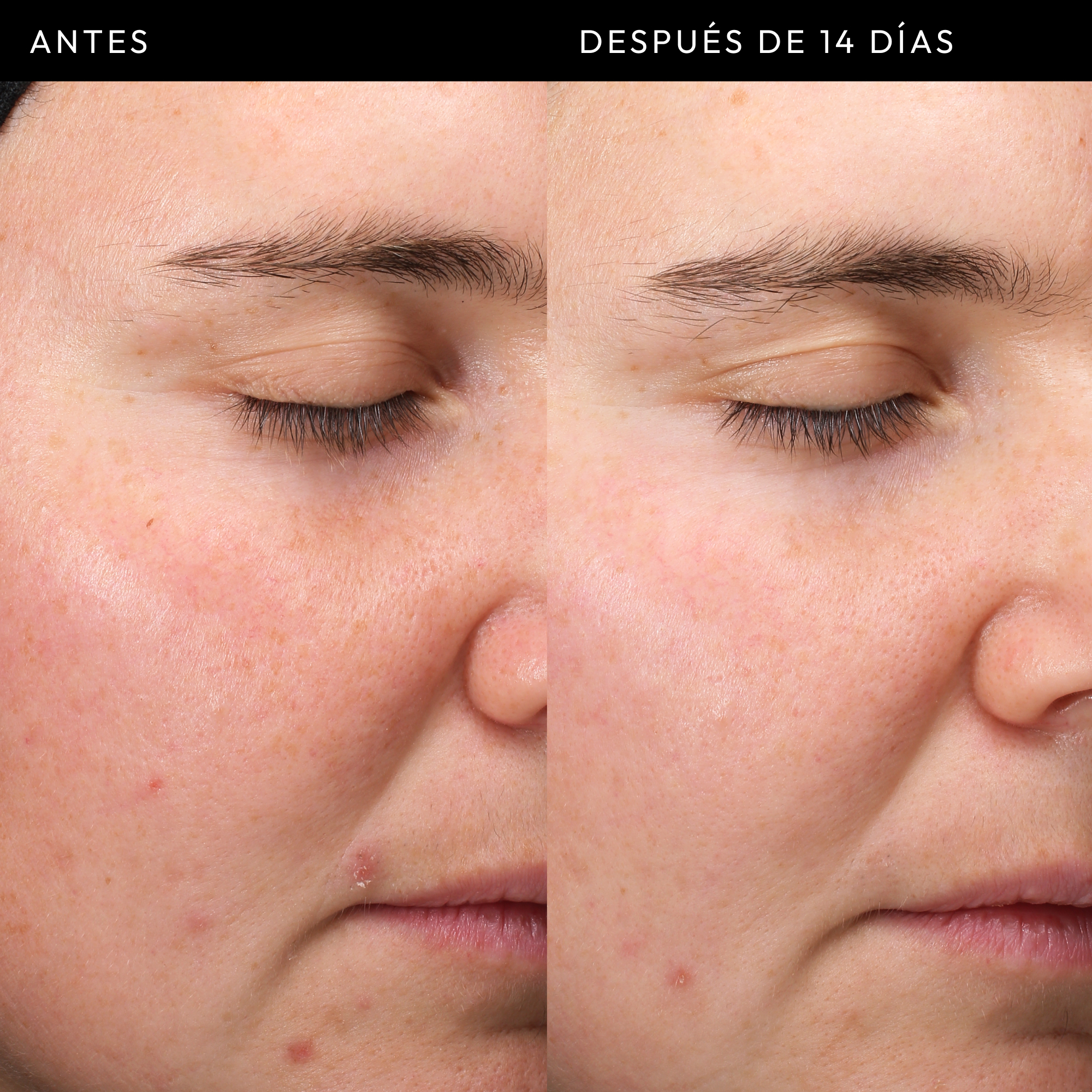 EXOSOME HYDRO-GLOW COMPLEX SERUM (SUERO PARA ROSTRO)
